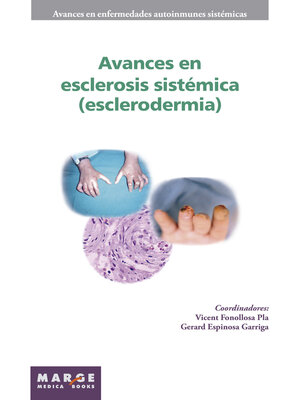 cover image of Avances en esclerosis sistémica